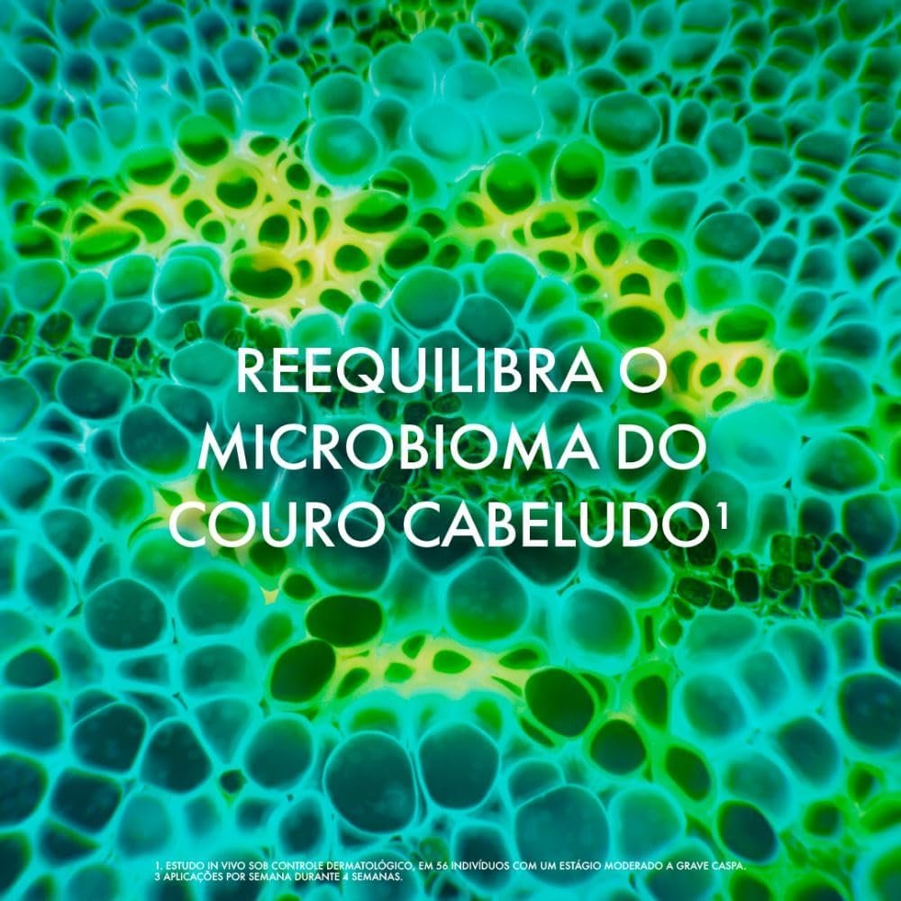 Vichy Dercos Shampoo Anticaspa DS para Cabelos Normais a Oleosos, Elimina 100% da Caspa Visível e Coceira, Ação Antirreincidência por 6 Semanas, Controla a Oleosidade, 300g - Imagem 12